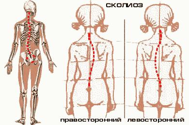 КАК УБРАТЬ СКОЛИОЗ ЗА ОДИН!!! СЕАНС. ВОПРОС - ОТВЕТ. Андрей Микулин